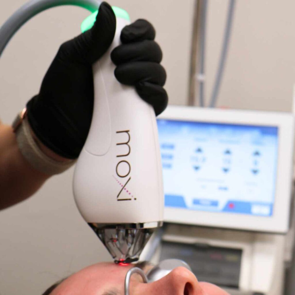Moxi Laser Sciton in Oklahoma City, OK