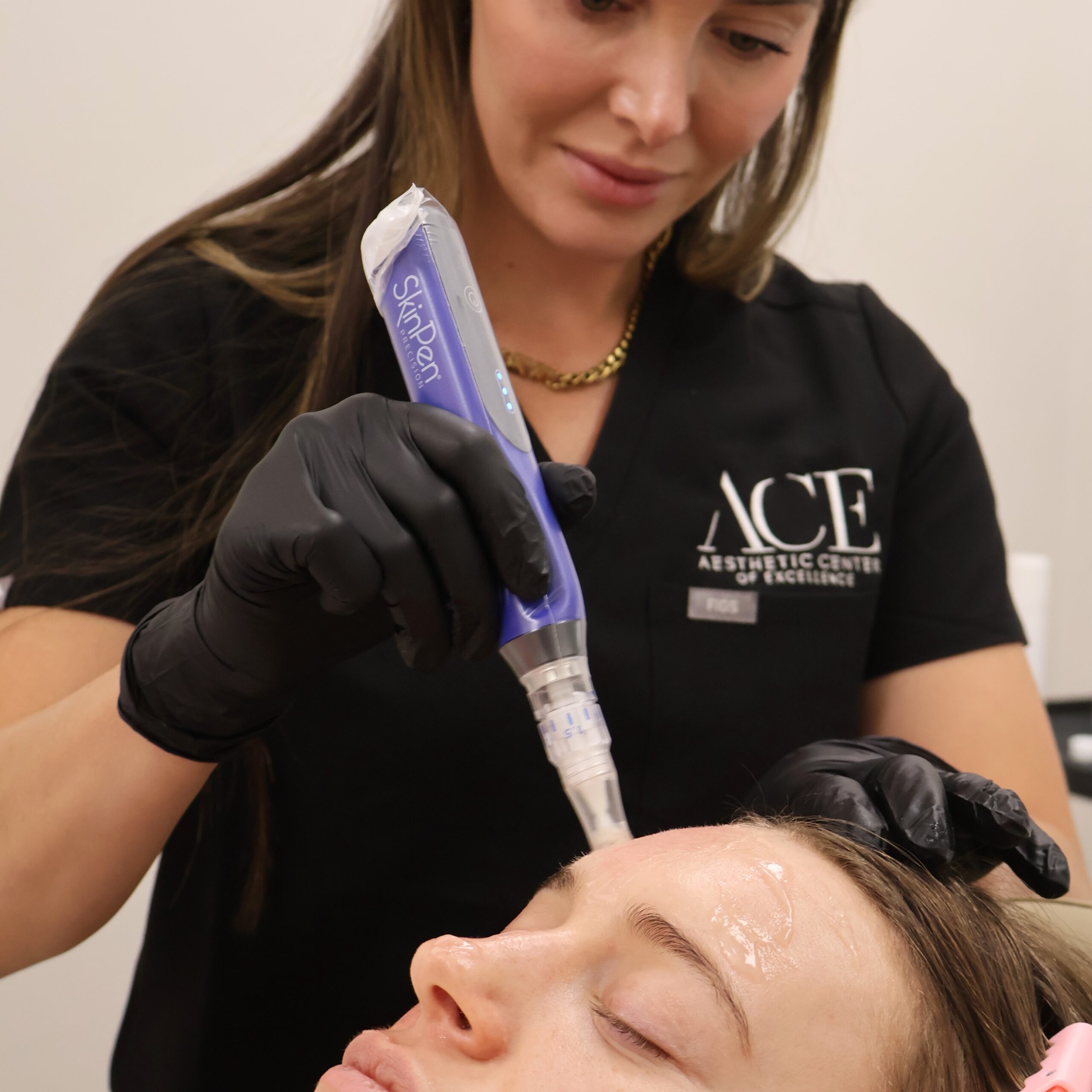 Skinpen Microneedling by ACE Medspa in Oklahoma City, OK