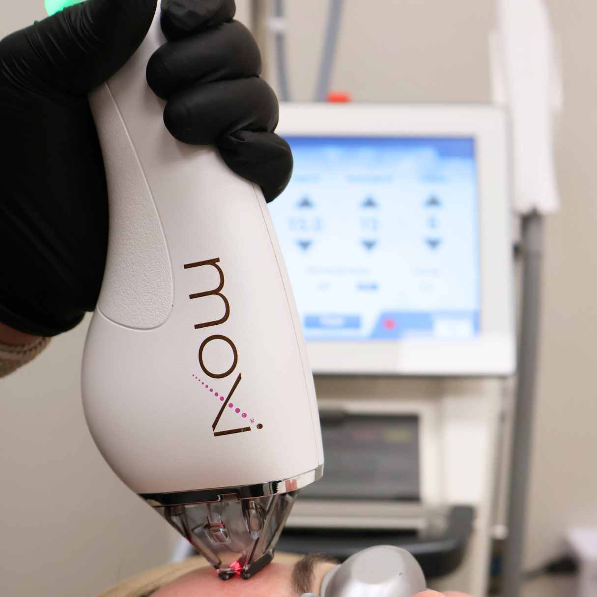 MOXI face treatment okc