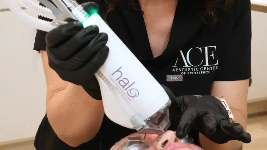 HALO for Fine Lines, Sun Damage, and Texture: One Laser, Multiple Solutions Halo laser in Oklahoma City at ace med spa
