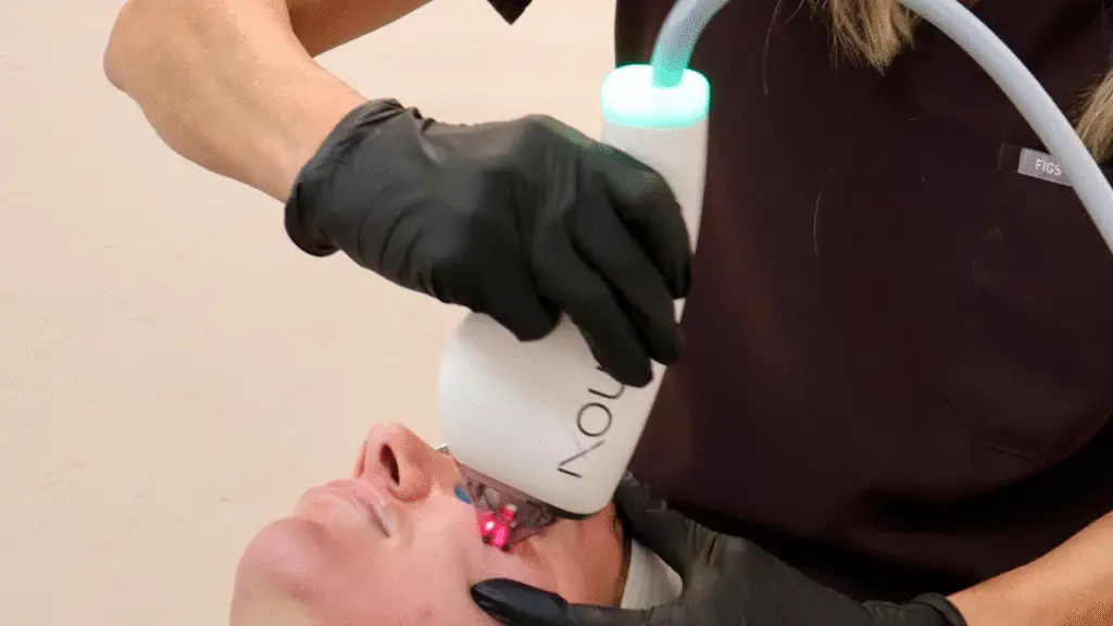 moxi laser treatment at Aesthetic Center of Excellence