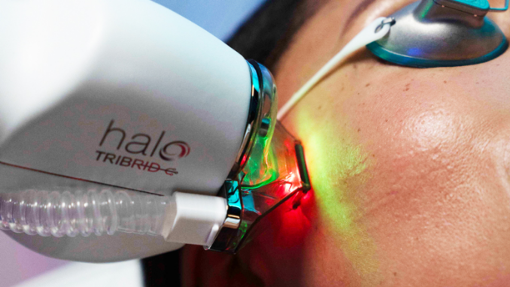 Is HALO Tribrid Right for You: Who Benefits Most from This Advanced Resurfacing Treatment Tribrid HALO in oklahoma city at ACE